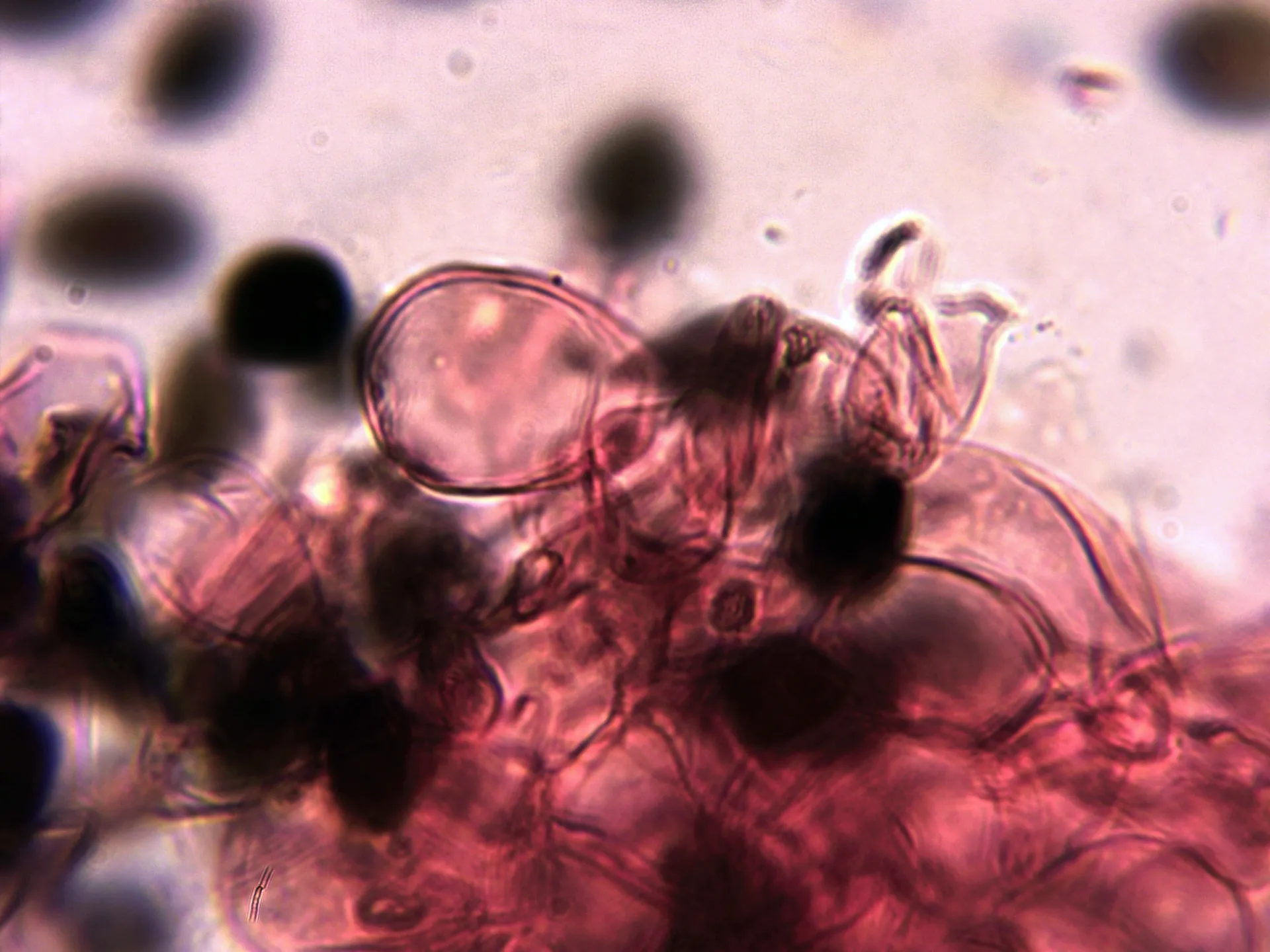 Microscopía de Panaeolus papilionaceus - 5 - Cutícula